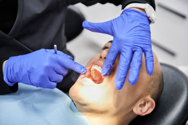 Best Emergency Dentist for Lost Fillings or Crowns in Blue Ridge, GA