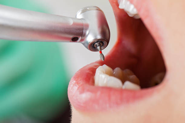 Best Pediatric Emergency Dentist in Blue Ridge, GA